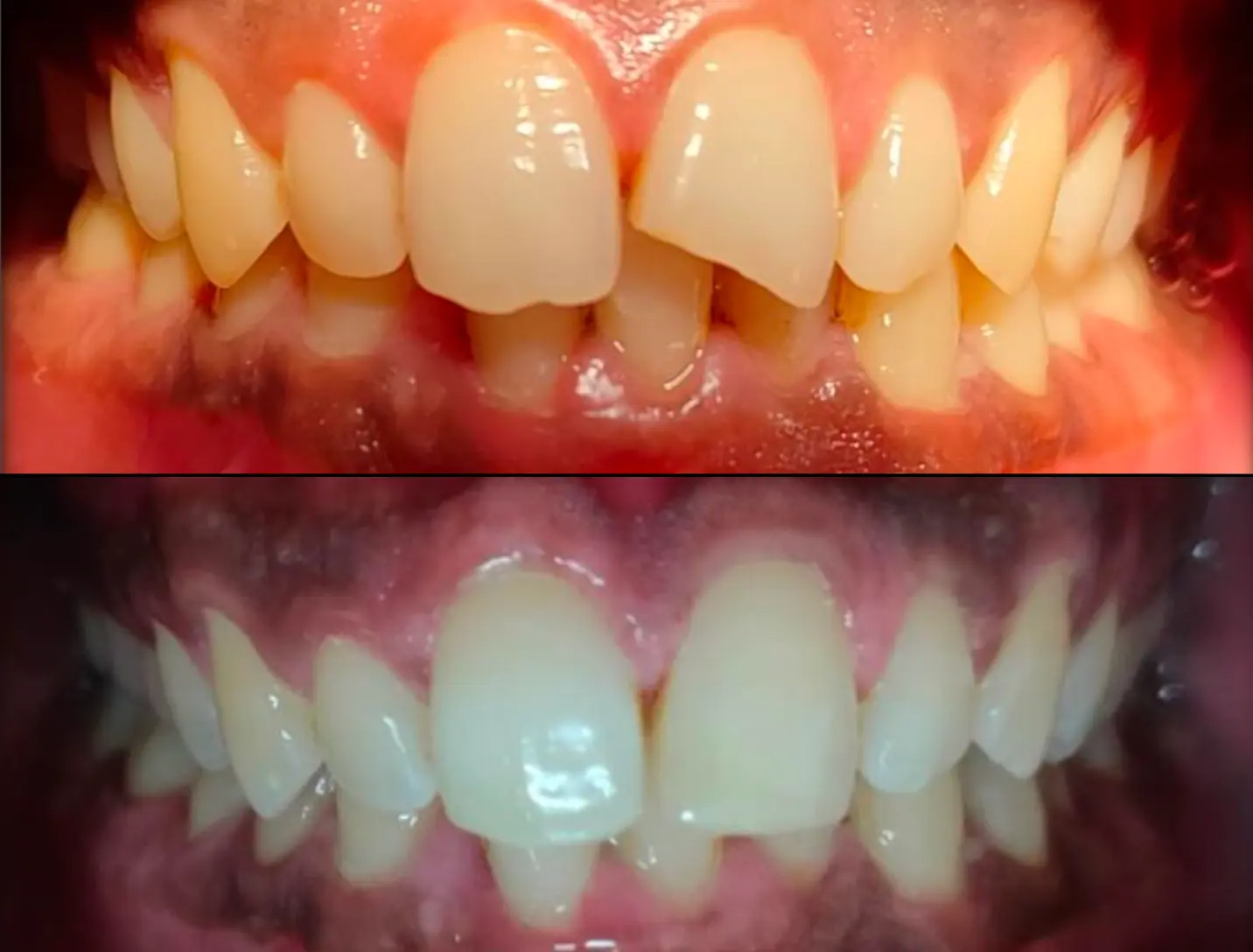 Before & After Case 1