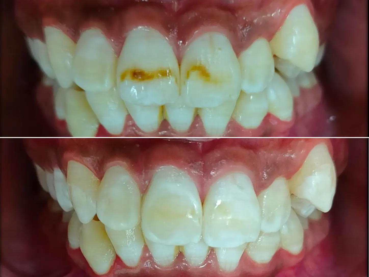 Before & After Case 2
