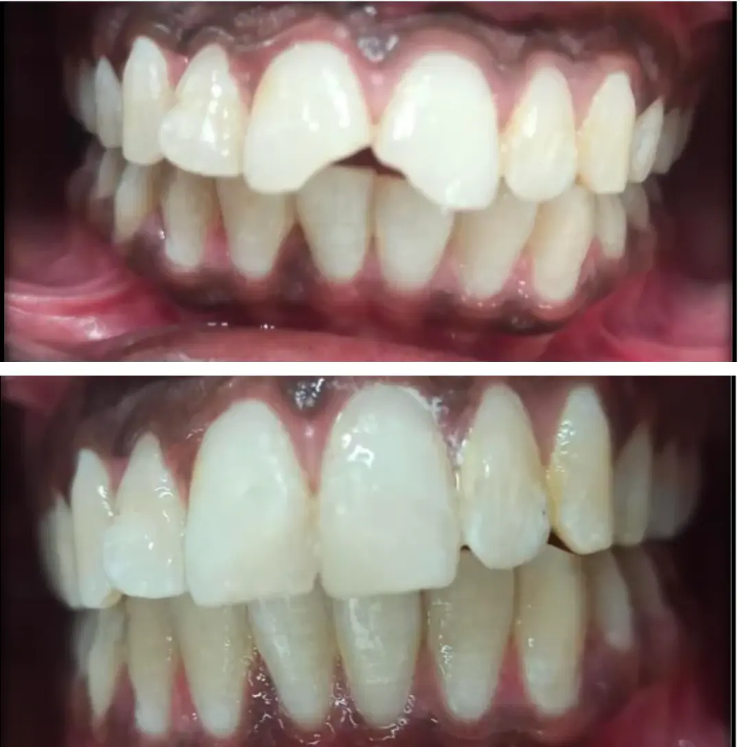 Before & After Case 3