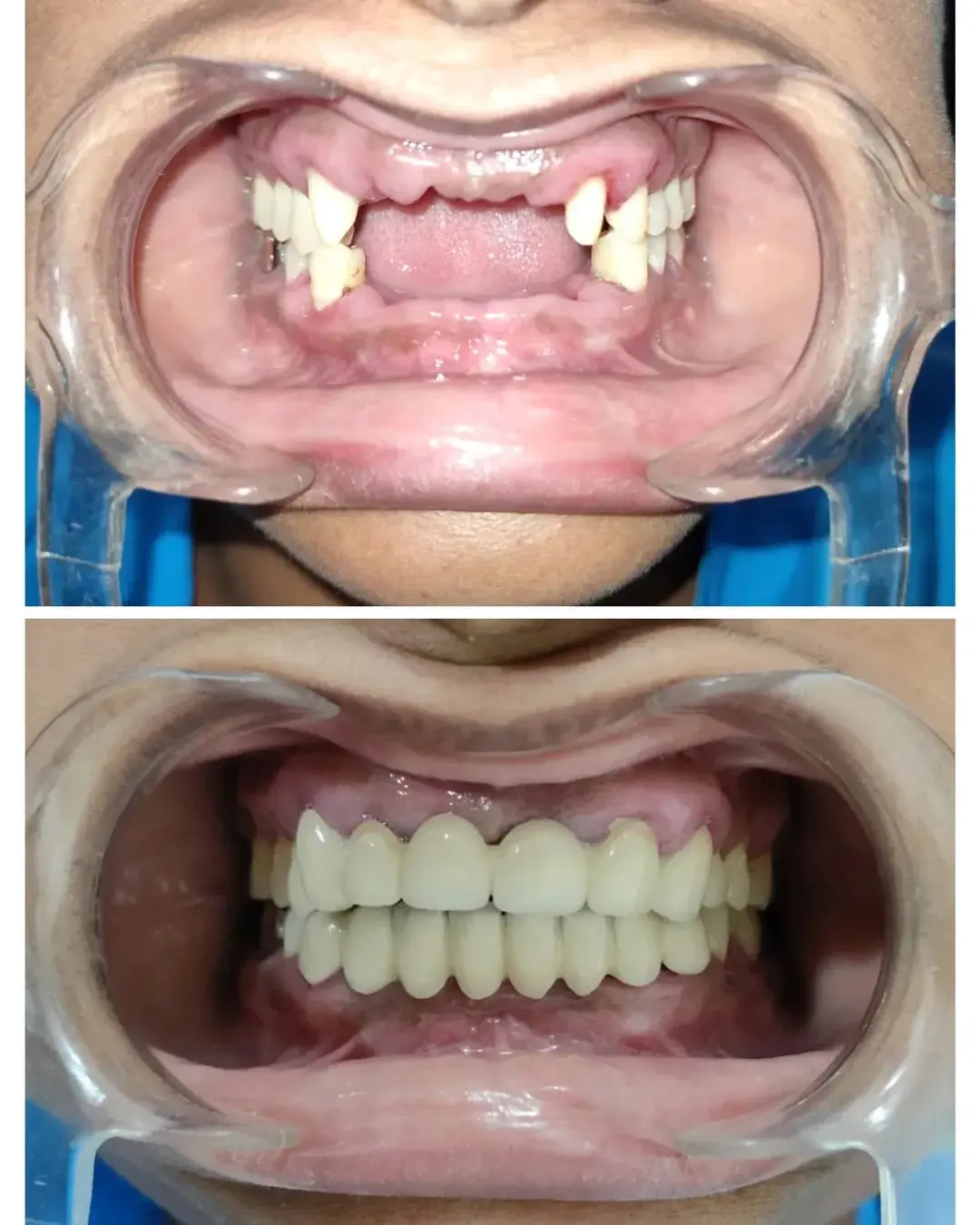 Before & After Results