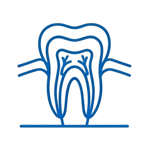 Root Canal